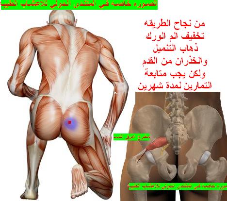 كسر الفقرة الانضغاطي هو كسر يحدث في فقرة