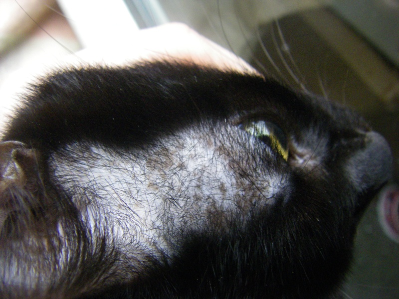 taches de pigmentation brunes